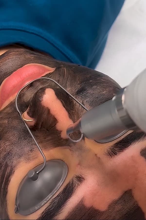 Legends Academy Abbotsford — Close Up Facial And Laser Removal, Abbotsford BC