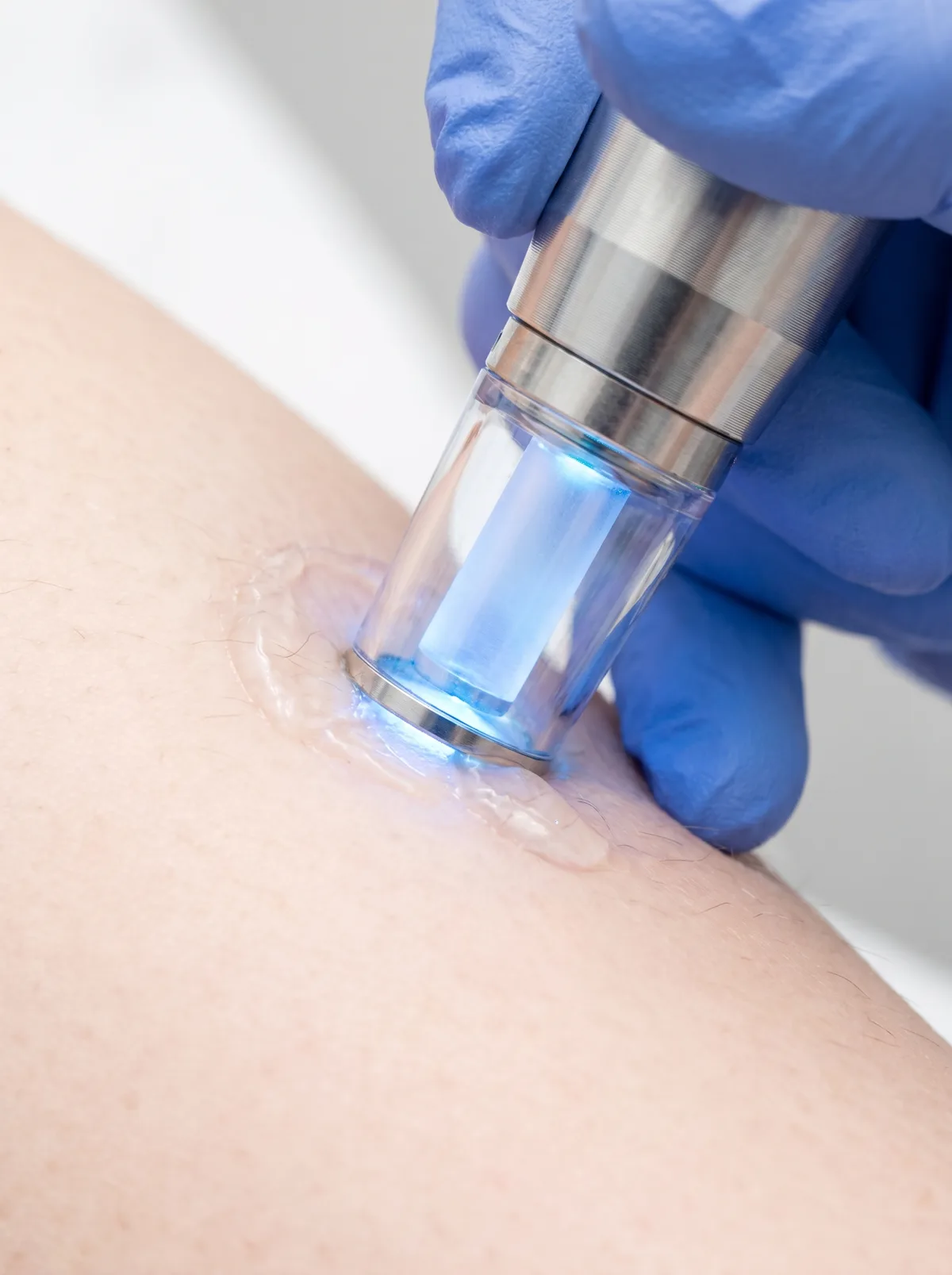 Close-up of a full face laser hair removal service at Legends Academy